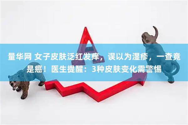 量华网 女子皮肤泛红发痒，误以为湿疹，一查竟是癌！医生提醒：3种皮肤变化需警惕